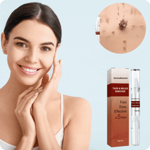 DermaRemove™-penna | Tar bort vårtor och fläckar smärtfritt på 3 dagar!