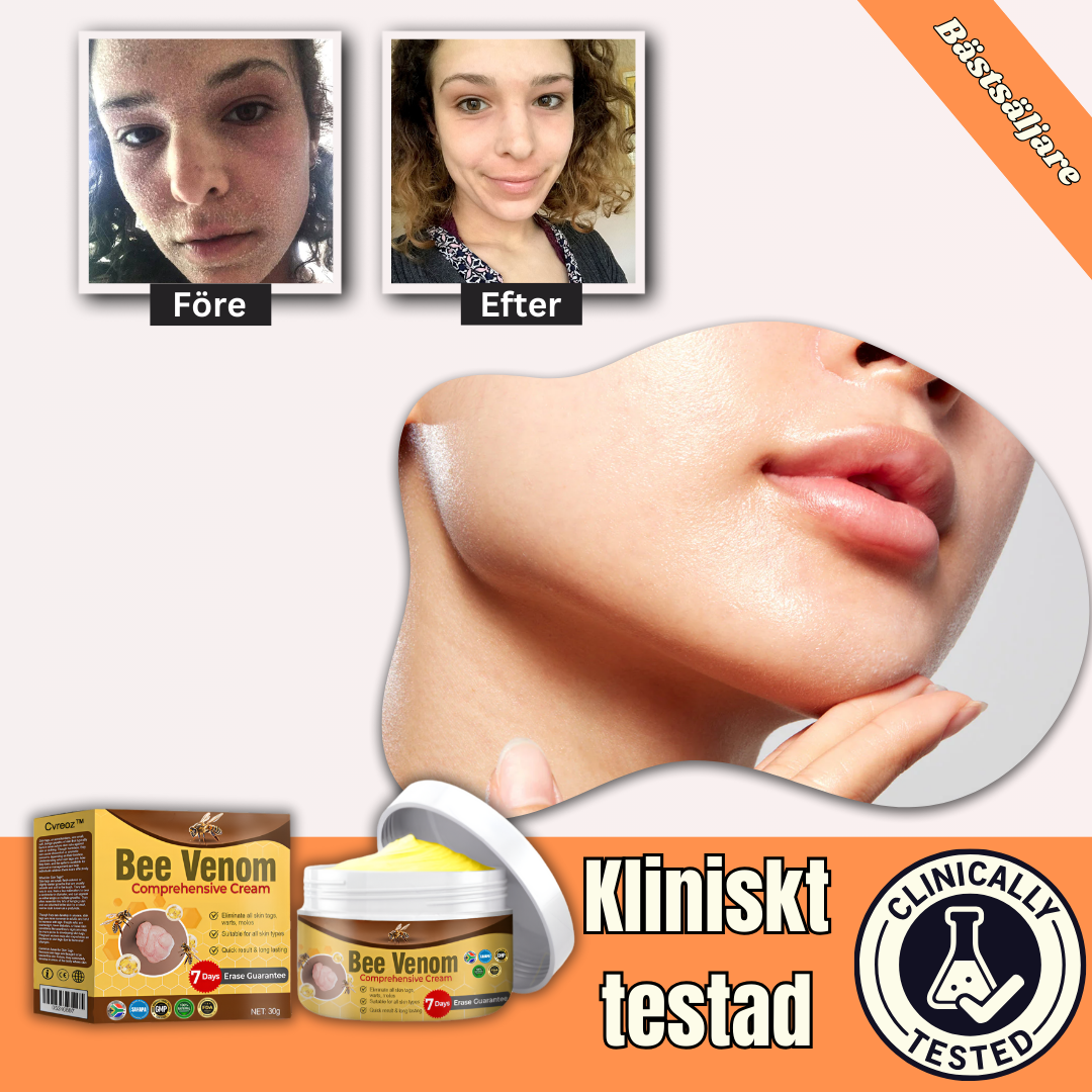 PureBee™ - Kräm | Läker skadad hud inom 1–3 veckor