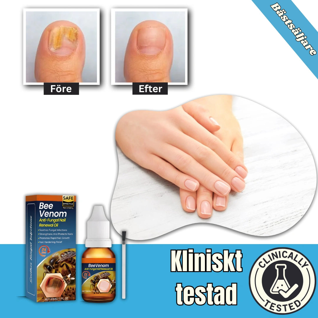 NailRenew™ - Oil | Få friskare, svampfria och upp till 4 gånger längre naglar!
