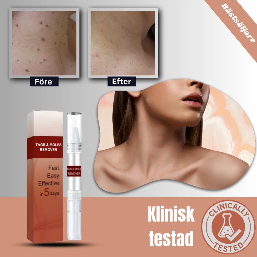 SkinSmooth™ - Cream | Eliminerar hudflikar på 6 dagar, utan ansträngning