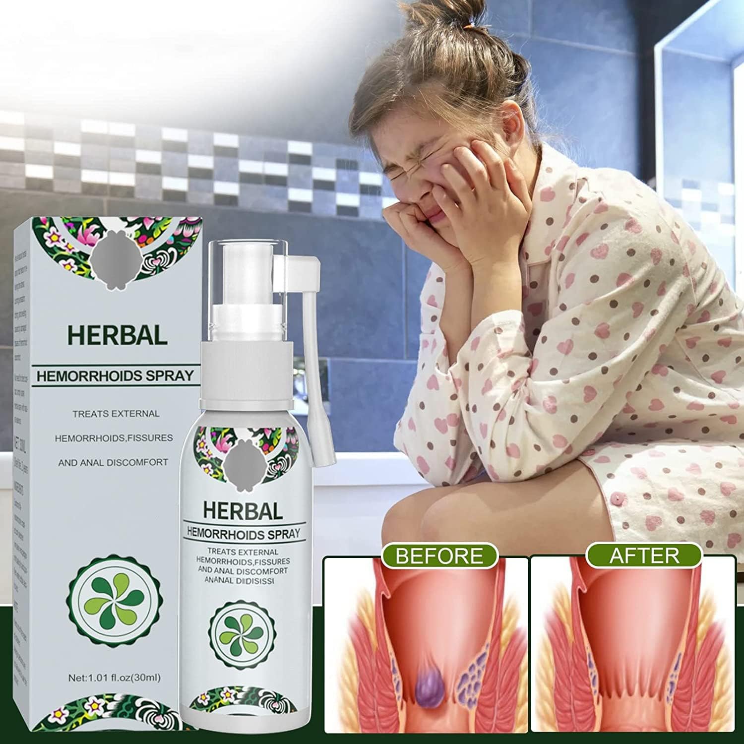 HealEase™ - Din naturliga lösning för hemorrojdlindring! | 1+1 Gratis