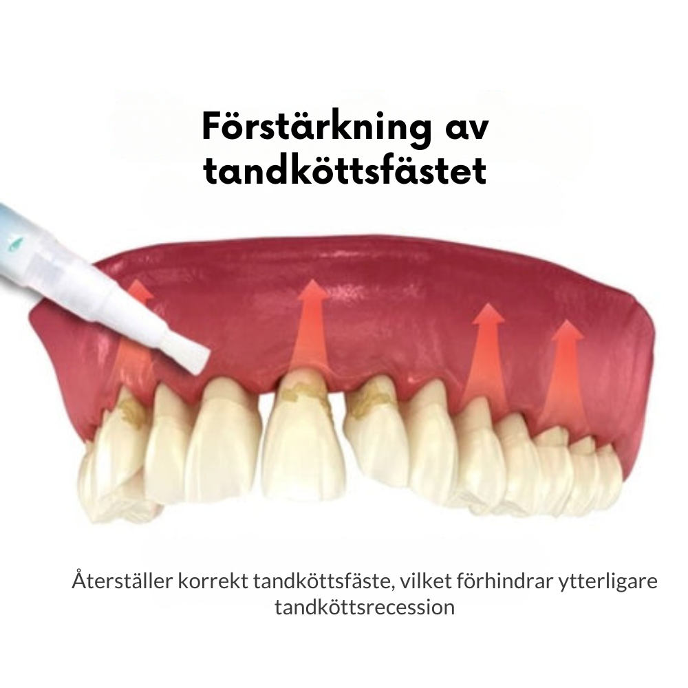 SmileGel™ - Återupptäck ditt leende med revolutionerande tandköttsbehandling | 1+1 Gratis