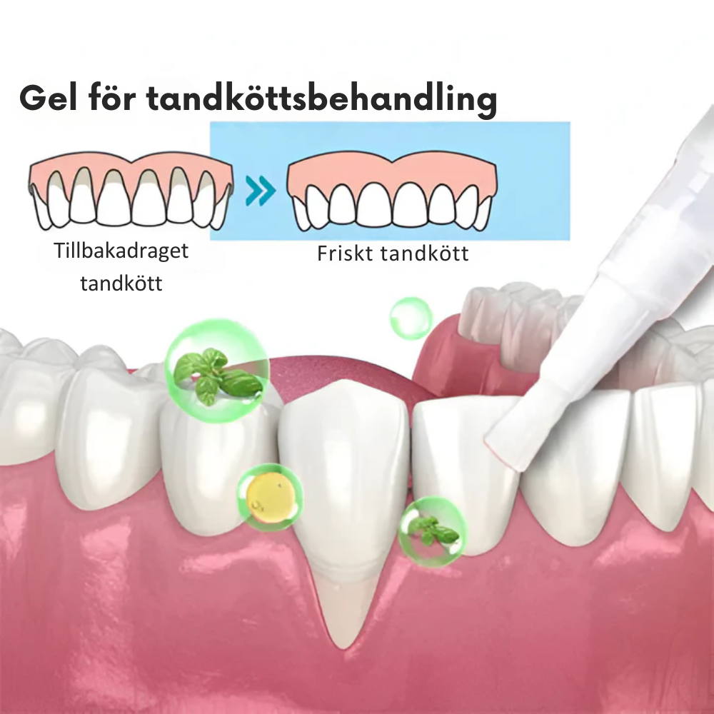 SmileGel™ - Återupptäck ditt leende med revolutionerande tandköttsbehandling | 1+1 Gratis