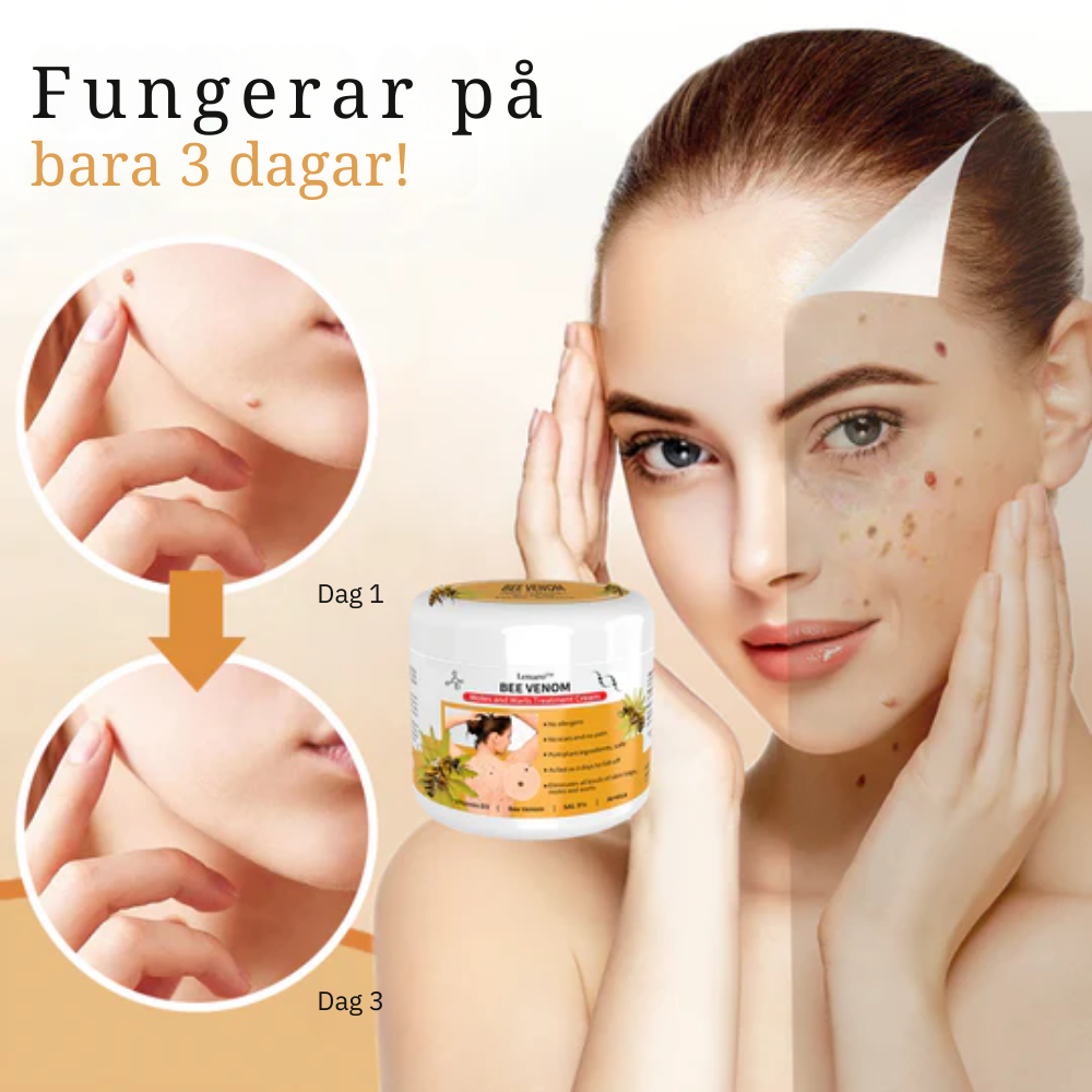 NaturaClear™ - Säg adjö till vårtor och få slät hud på bara några veckor! | 1+1 Gratis