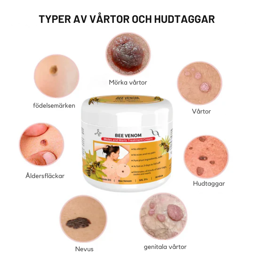 NaturaClear™ - Säg adjö till vårtor och få slät hud på bara några veckor! | 1+1 Gratis