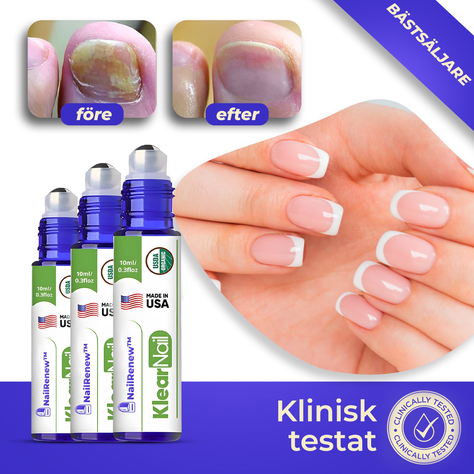 NailRenew™ - antisvamppenna | Eliminerar nagelsvamp på 5 dagar.