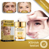 GlowLift™ - Cream | Minskar rynkor och påsar under ögonen med 92% på några minuter