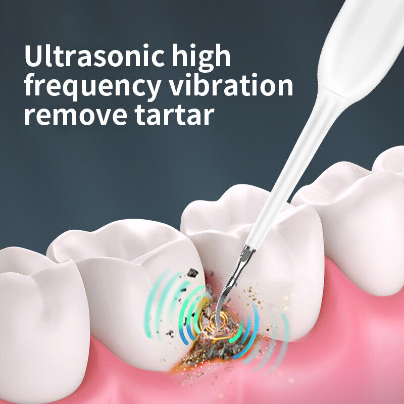 DentraSonic™ - din nyckel till ett strålande leende