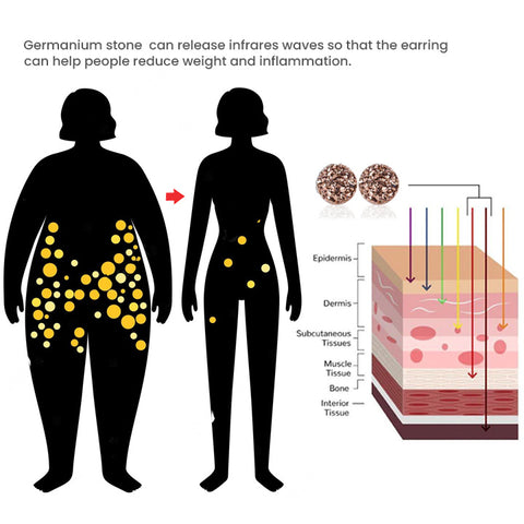 GemMagnet™ - Atheniz Magnetologi Lymfvävnad Germanium Örhängen