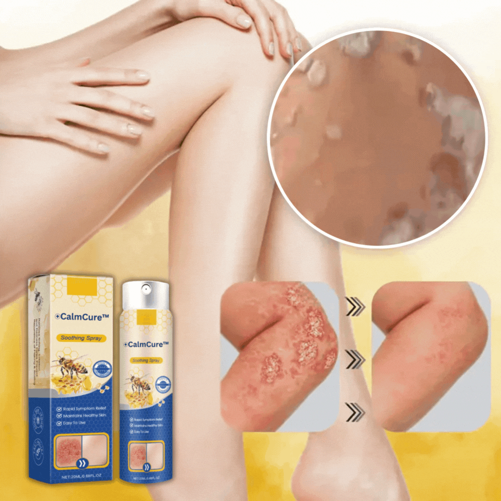 CalmCure™ PsoriaFix | Minskar klåda och rodnad med 87 % på 8 dagar