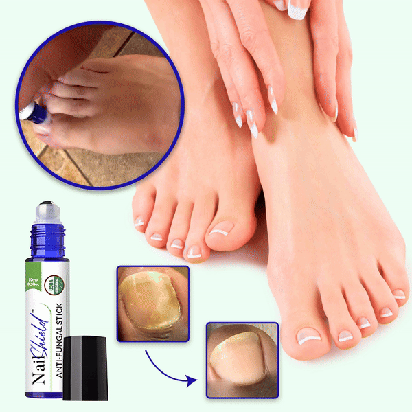 NailShield™ Antifungal Stick | Säg adjö till nagelsvamp på bara 5 dagar!