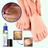 NailShield™ Antifungal Stick | Säg adjö till nagelsvamp på bara 5 dagar!