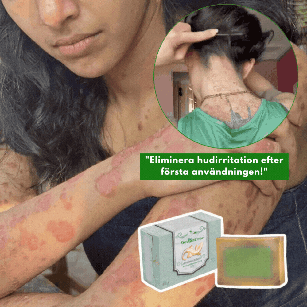 DermaCroc™ Krokodilolja Tvål | Eliminerar Eksem & Psoriasis på 48 timmar